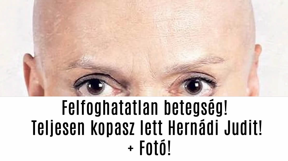 Felfoghatatlan betegség! Teljesen kopasz lett Hernádi Judit! + Fotó!