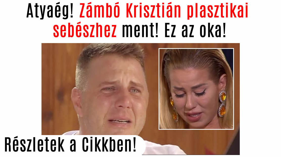 Atyaég! Zámbó Krisztián plasztikai sebészhez ment! Ez az oka!