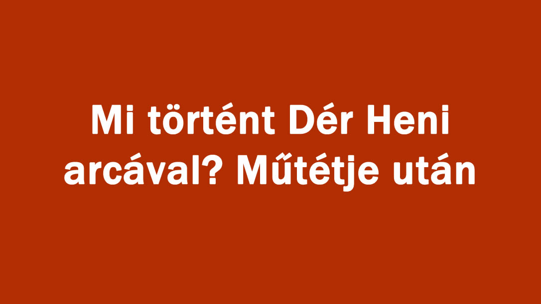 Mi történt Dér Heni arcával? Műtétje után